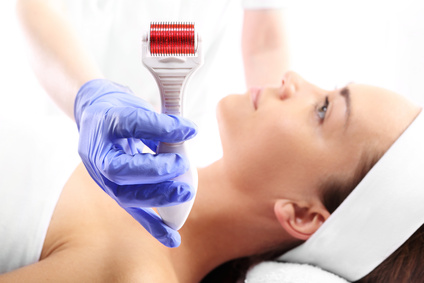 Microneedling